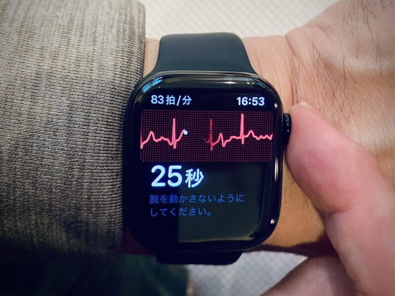 iPhoneヘルスケアアプリの概要画面。心電図・高血圧パターン通知・心房細動の設定カードが表示されている